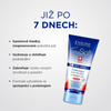 SOS krém na popraskané paty 15% urea
